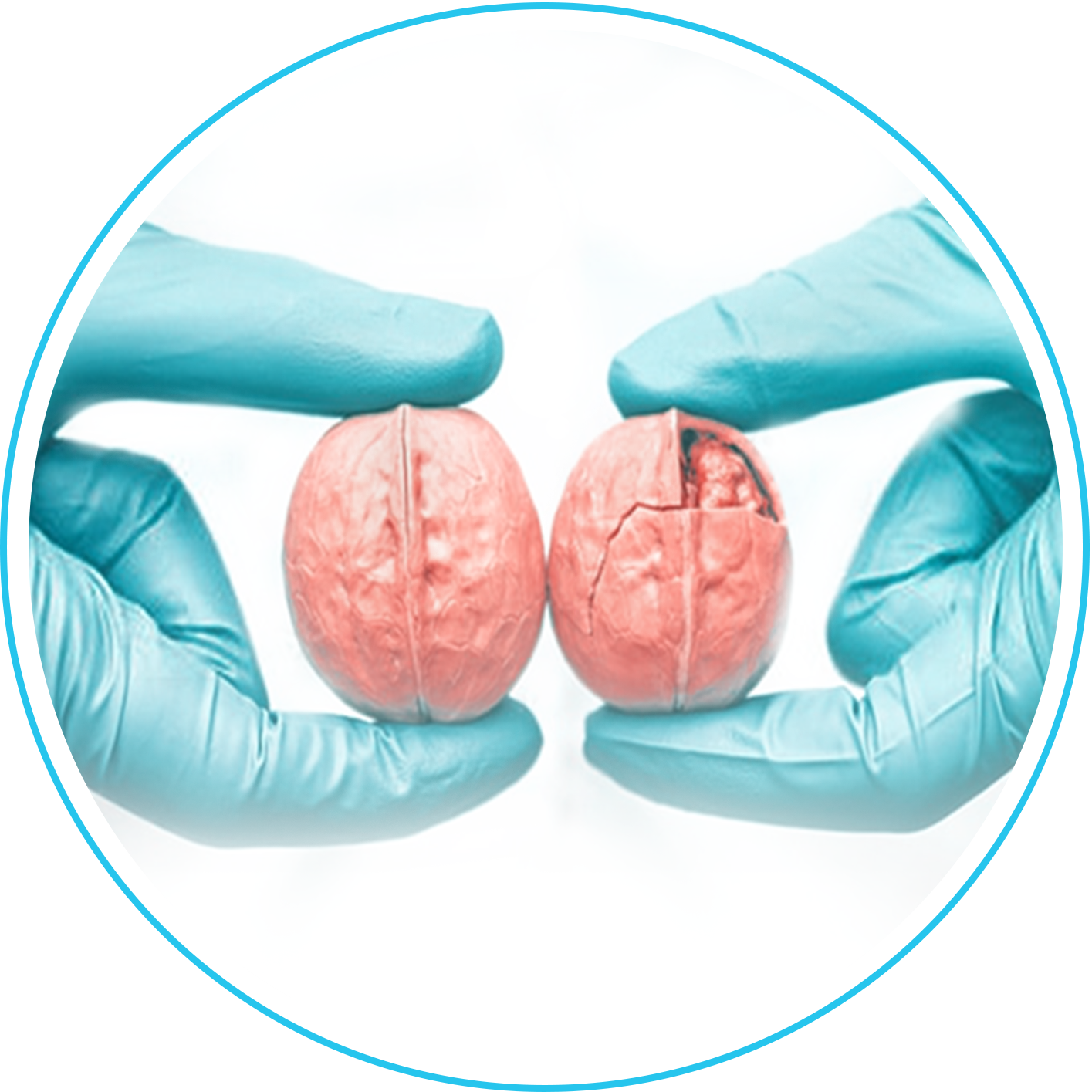 دوالي الخصية