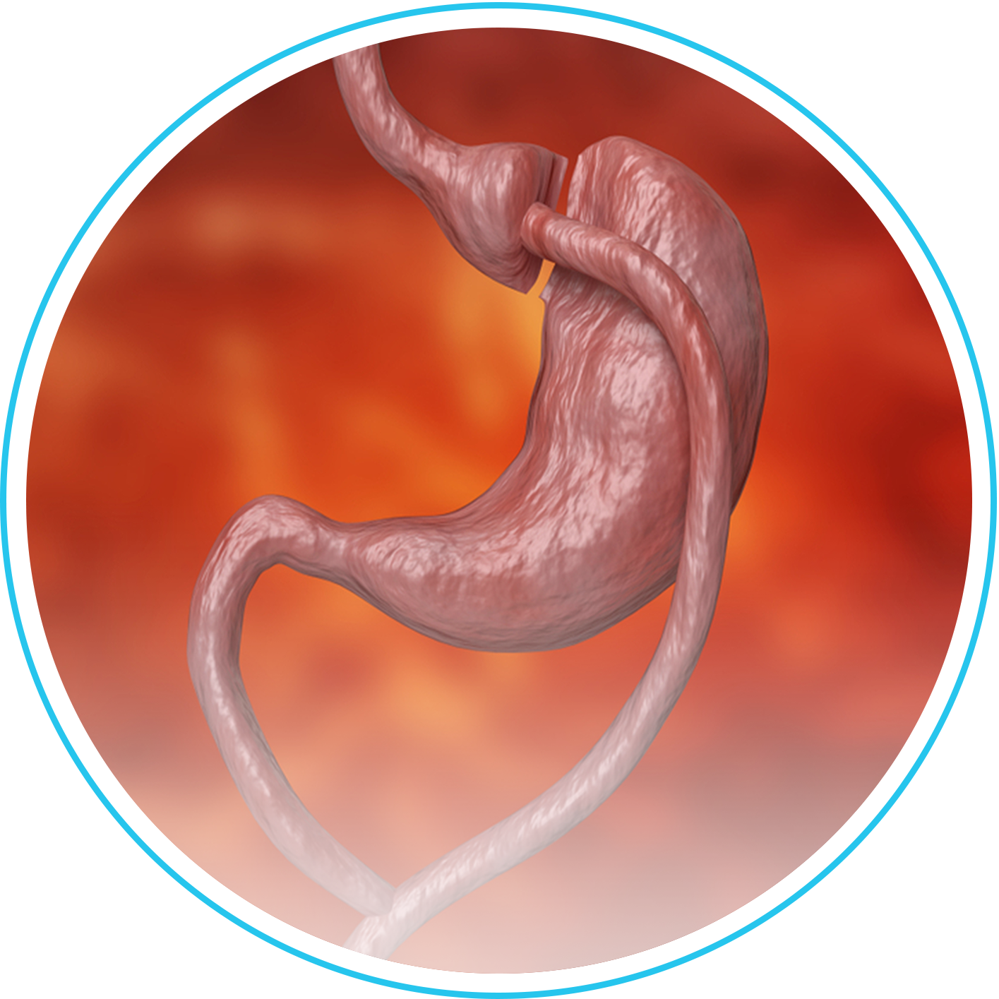 تحويل المسار