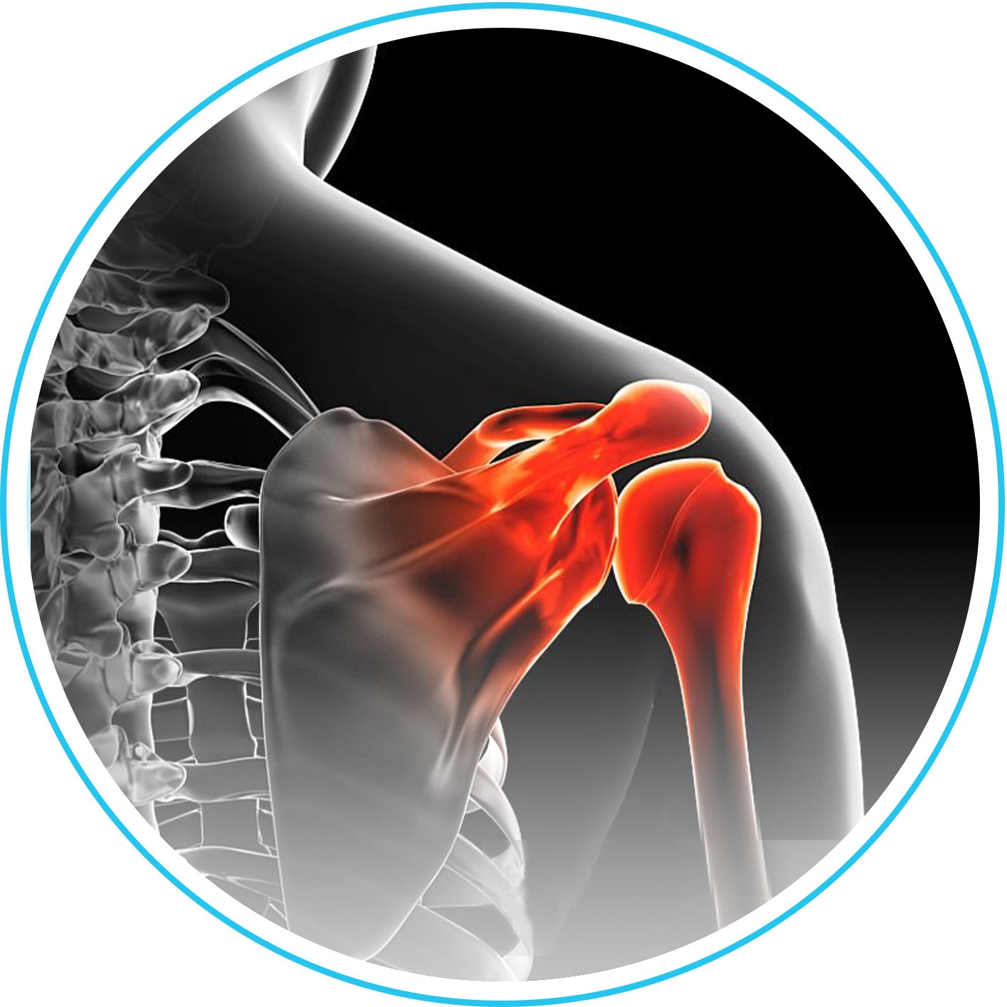 تغيير مفصل الكتف