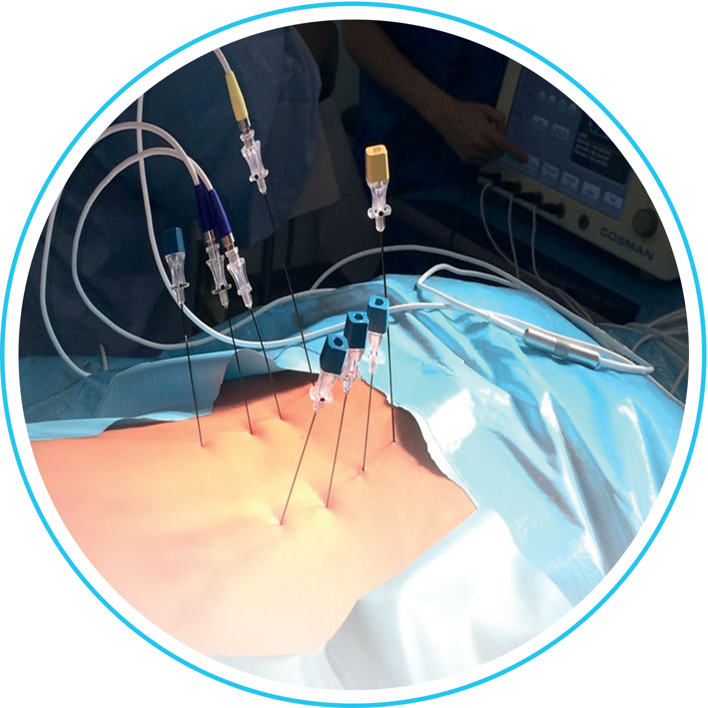 التردد الحراري