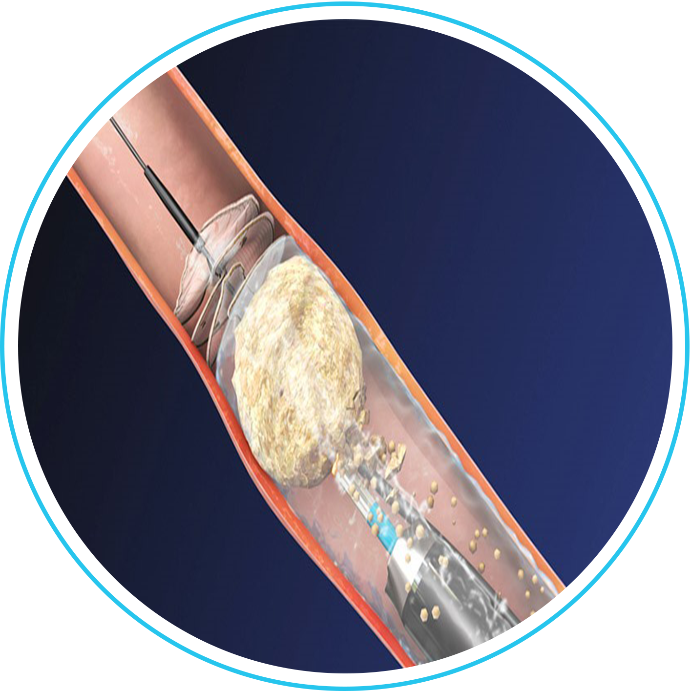 منظار الحالب