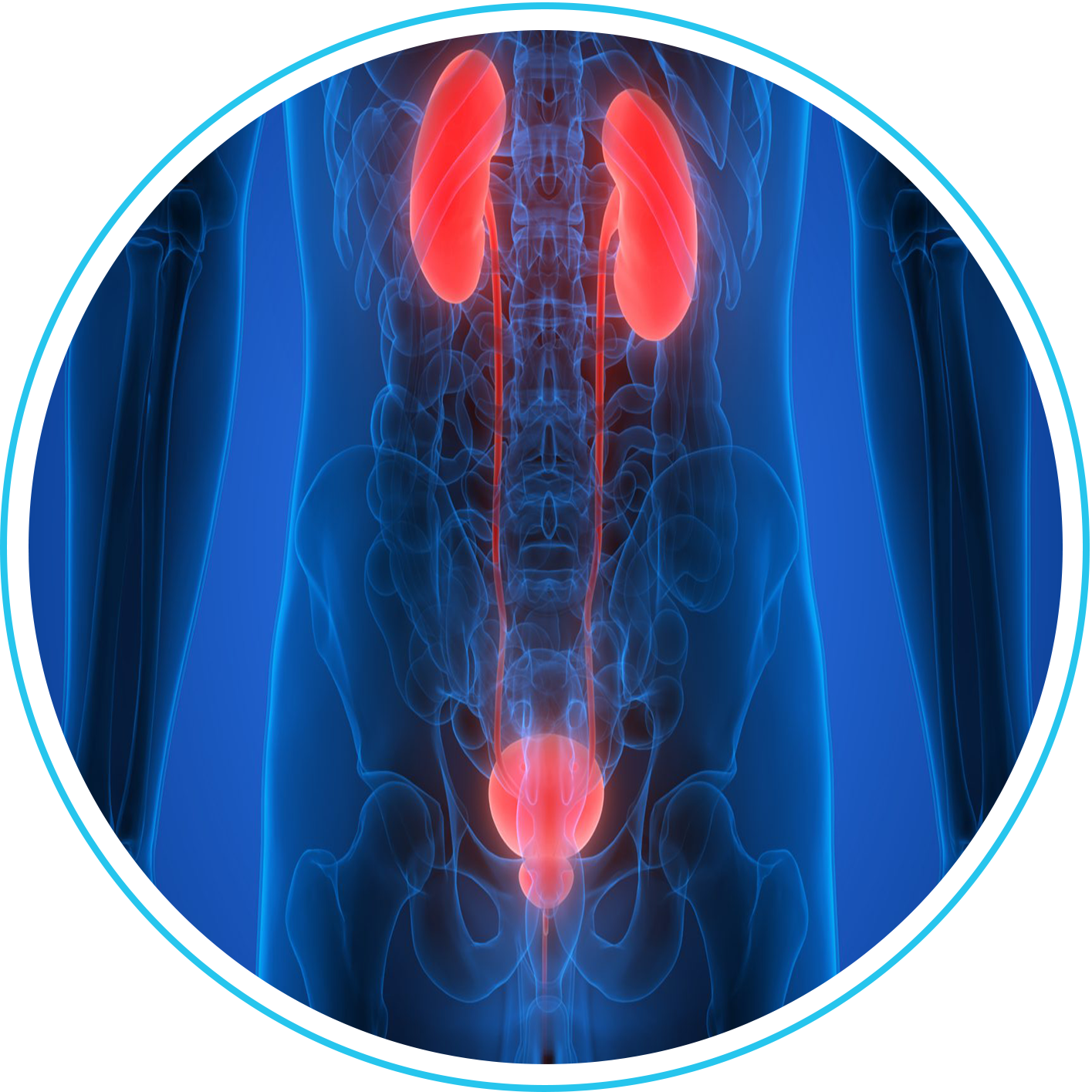 استئصال أورام الجهاز البولي