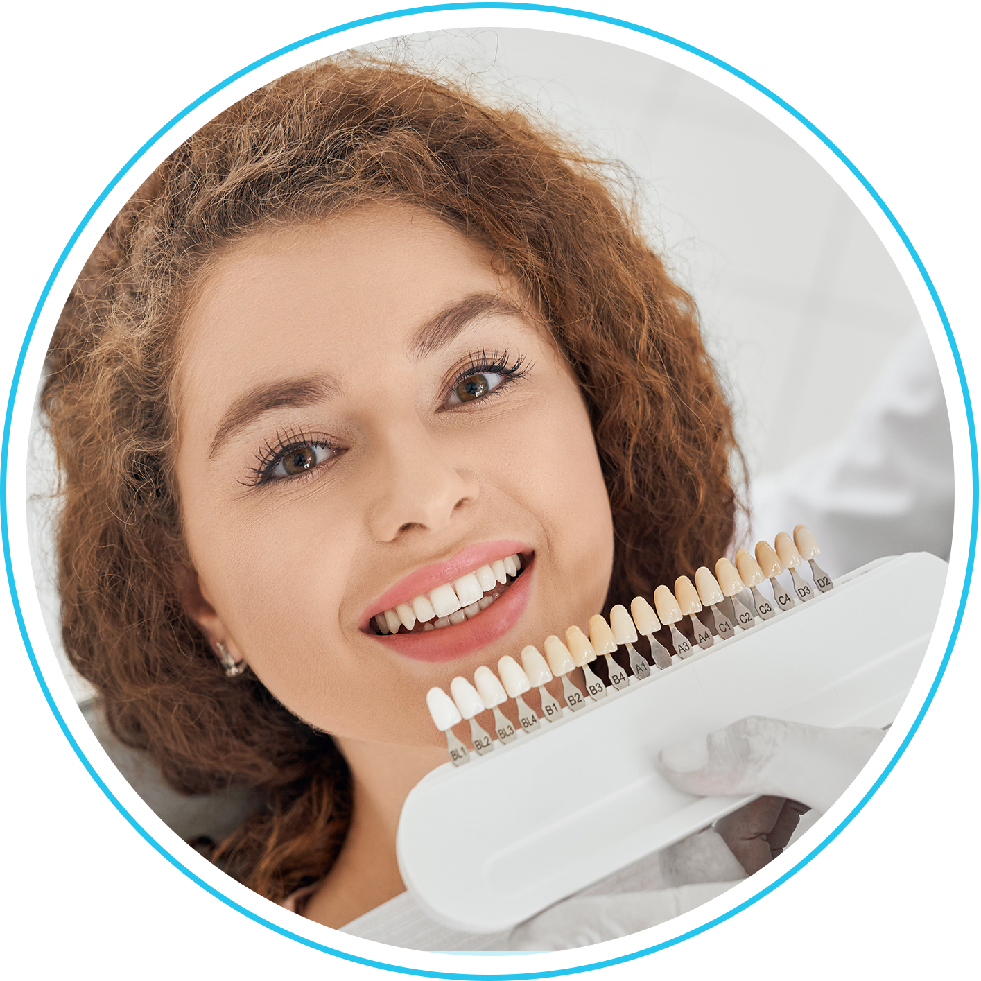 فينيير الأسنان ( قشرة الأسنان التجميلية )