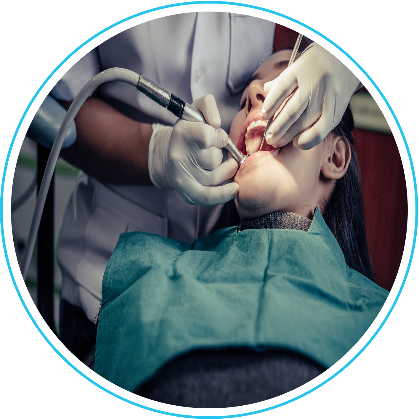 خلع الأسنان