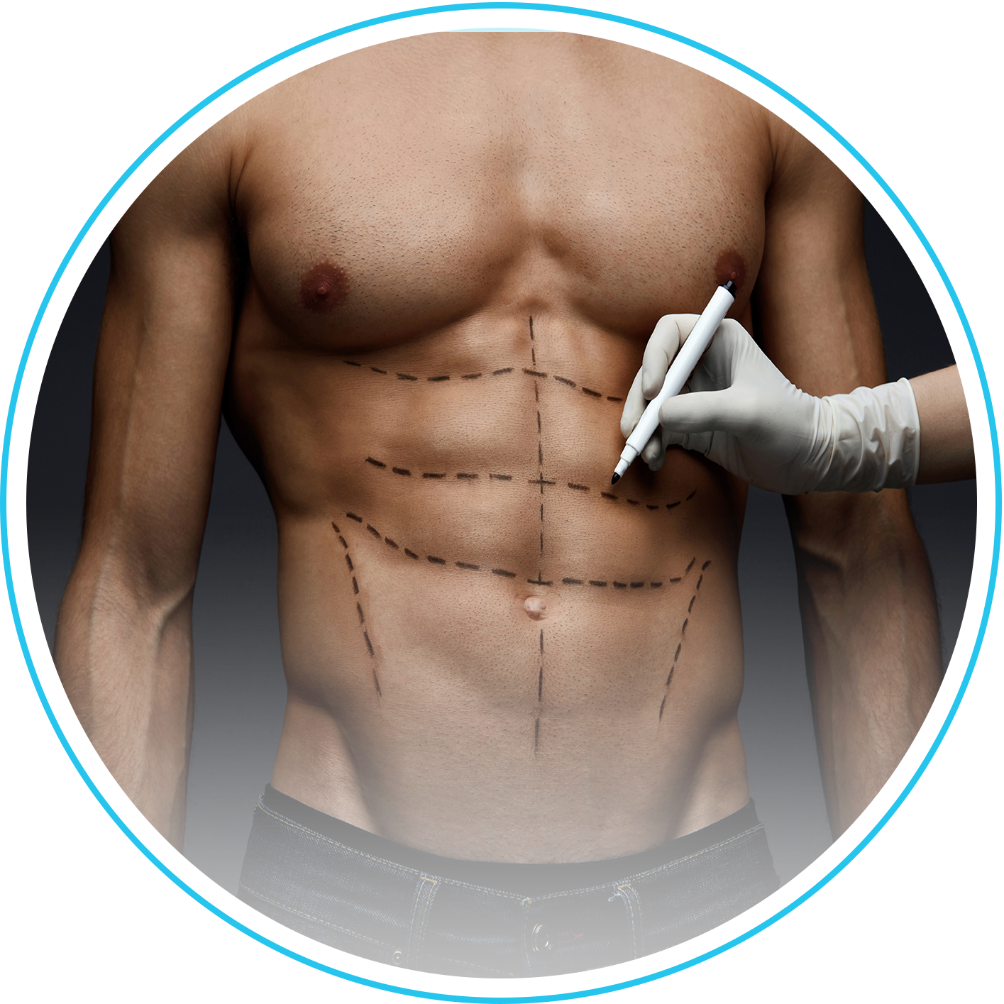 نحت الجسم رباعي الأبعاد