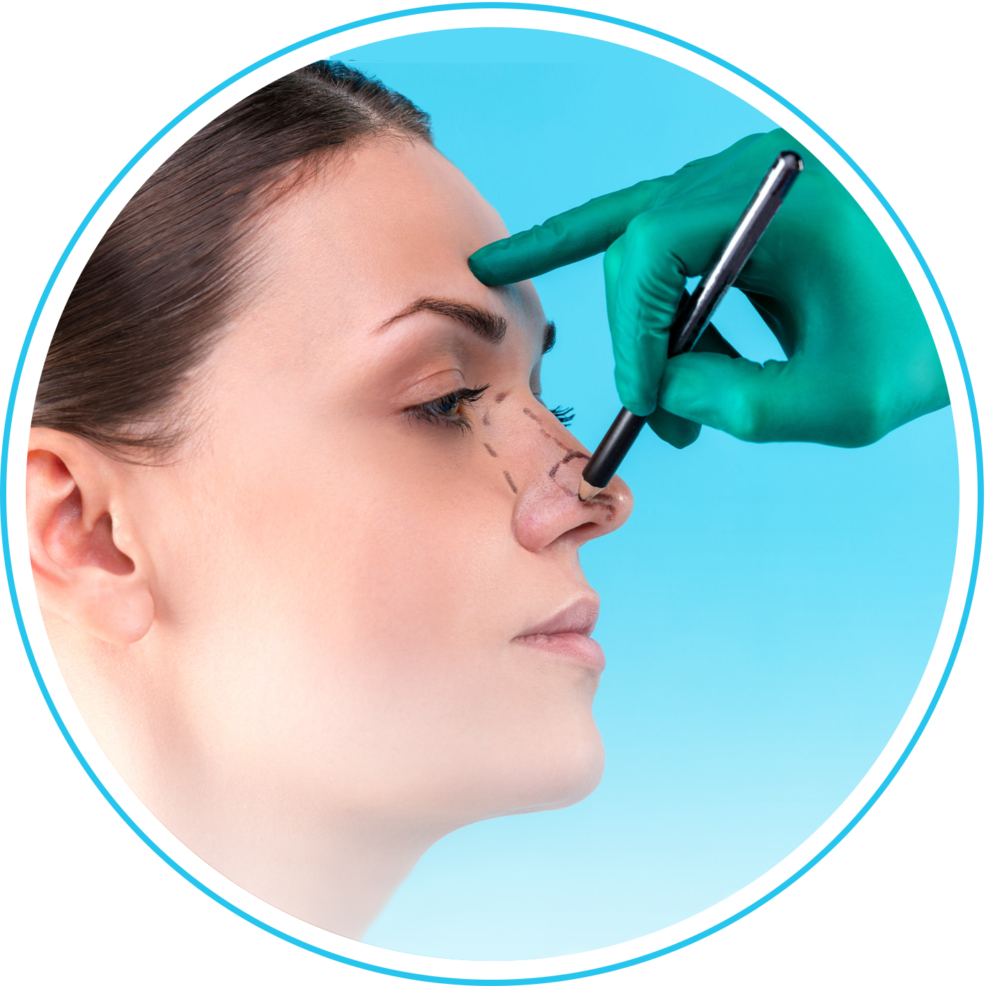 تجميل الأنف