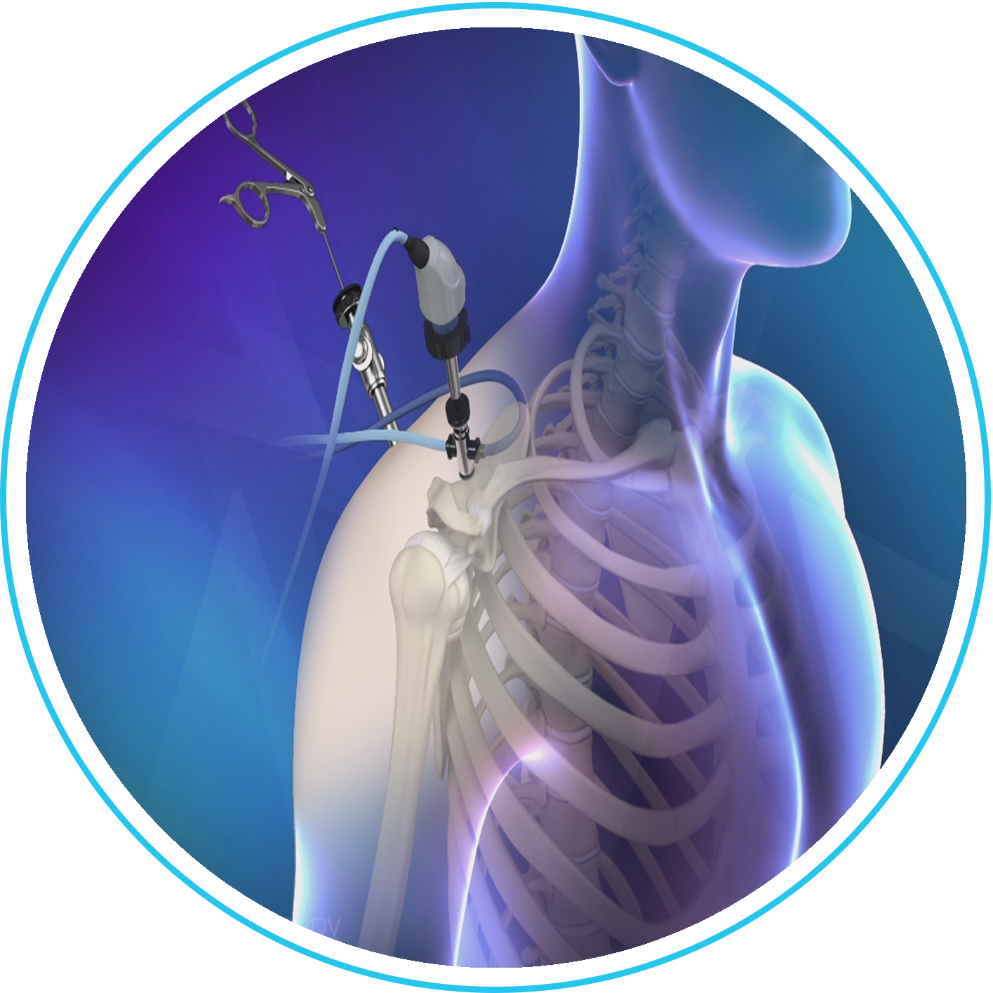 منظار مفصل الكتف