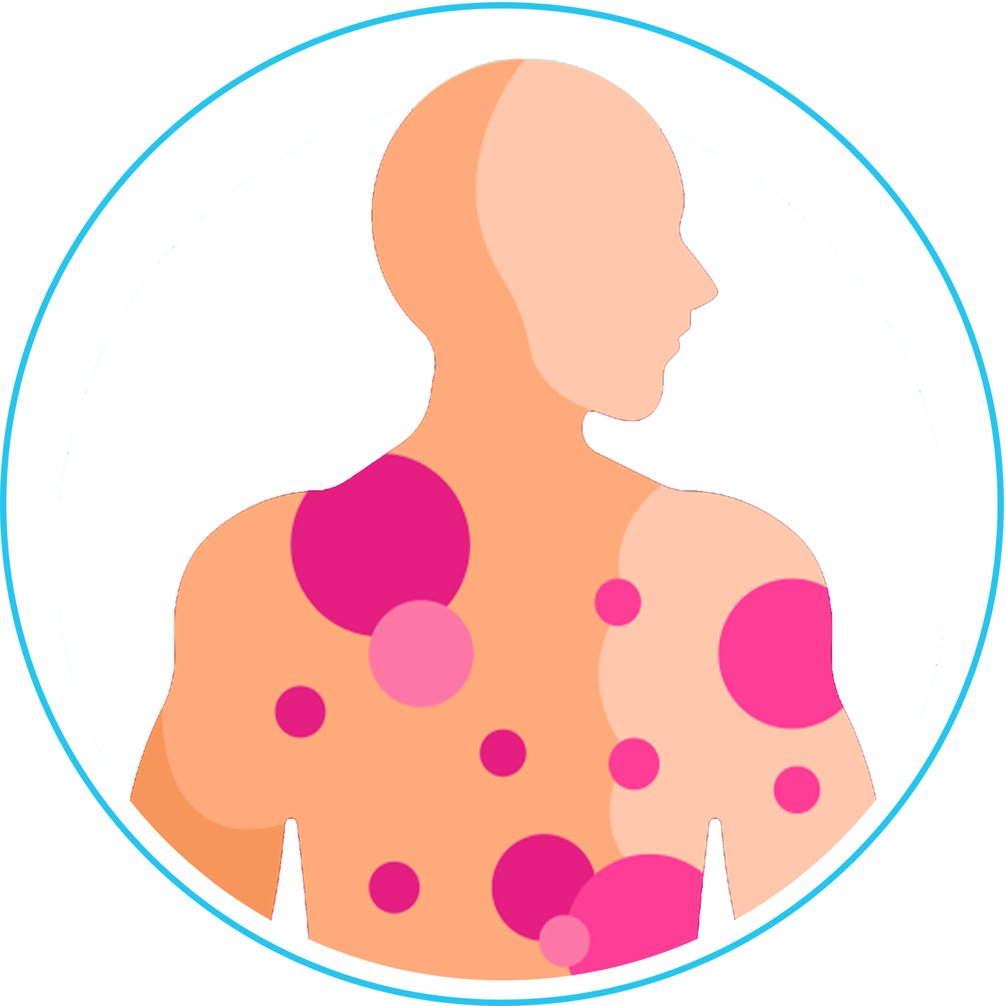 الأمراض الجلدية والليزر