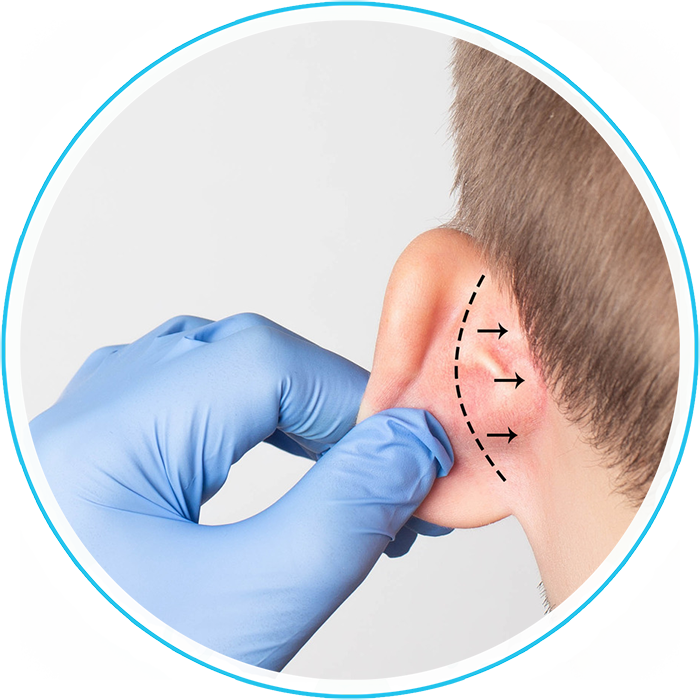 الأذن الخفاشية