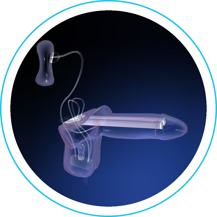 دعامة القضيب الهيدروليكية