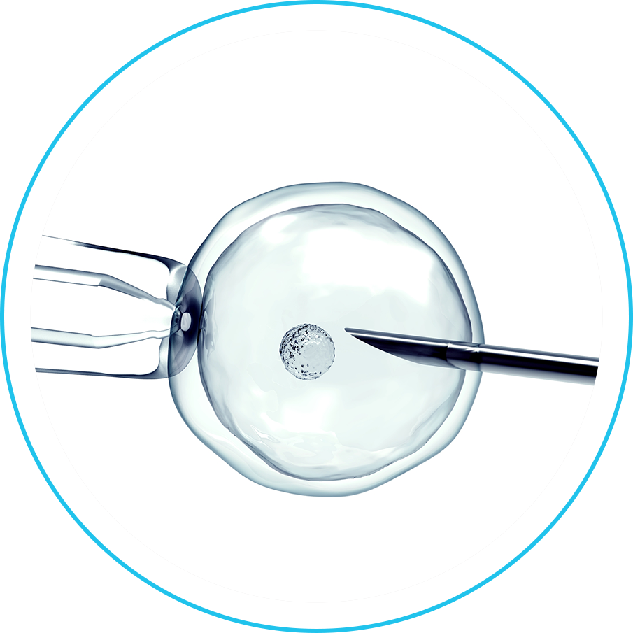 عملية الحقن المجهري