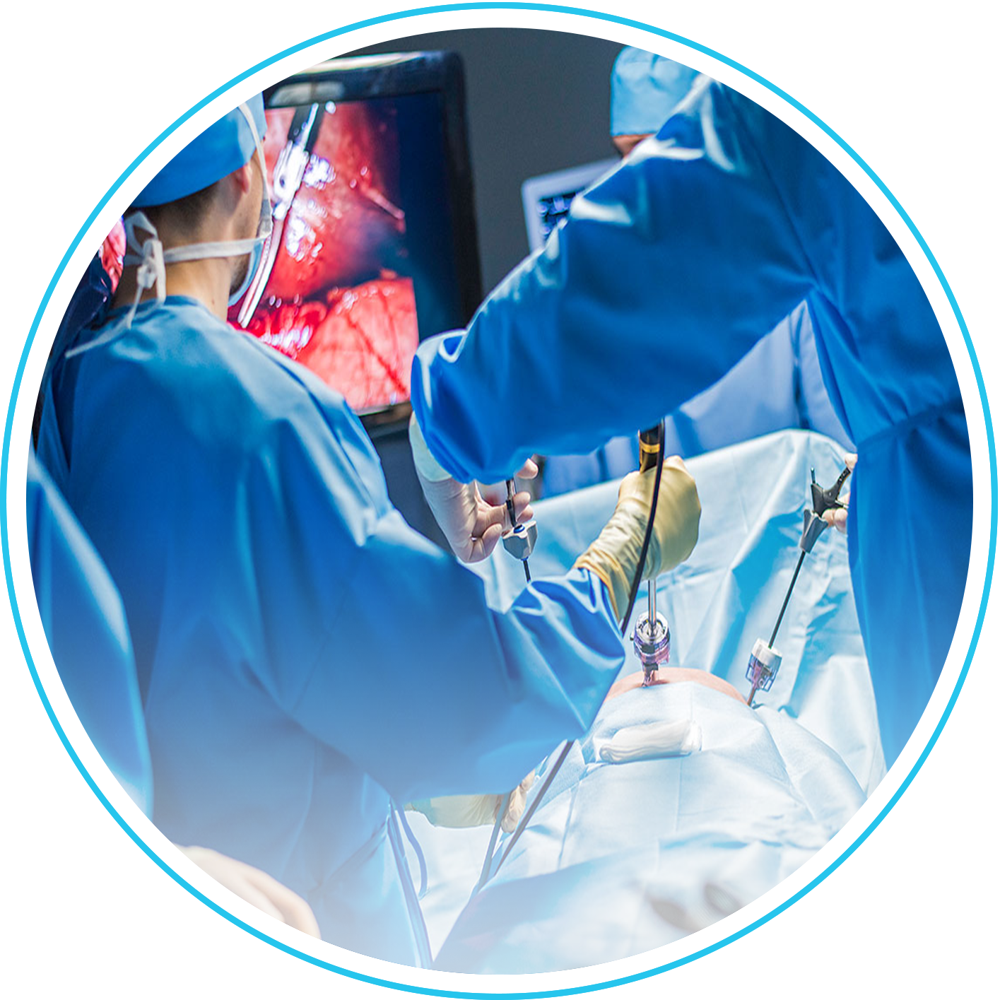 استئصال القولون